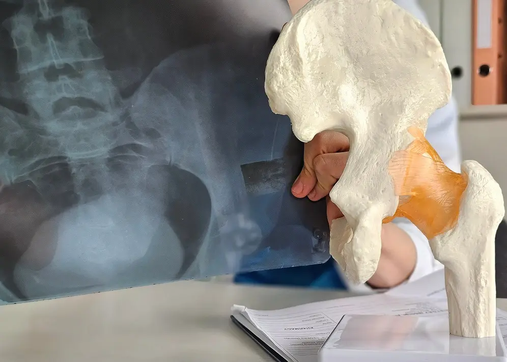 Hip & Knee Conditions