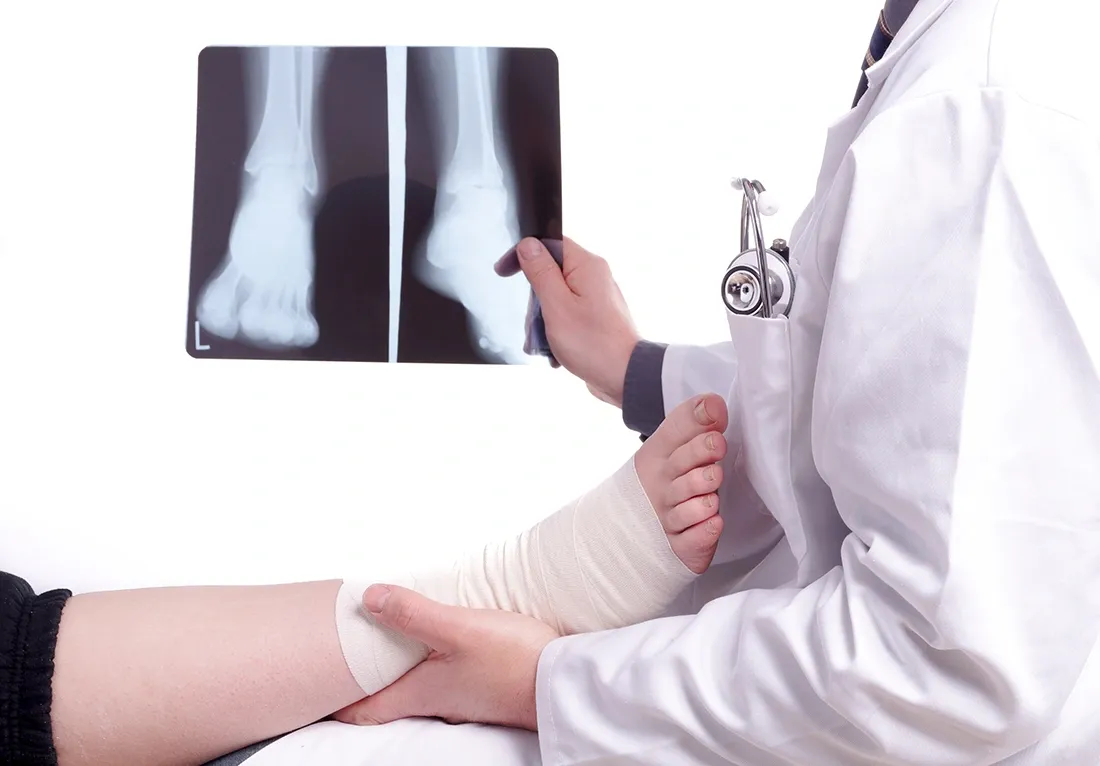 How Is a Sprained Ankle Diagnosed?
