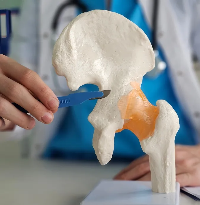 How Are Frozen Shoulder Diagnosed