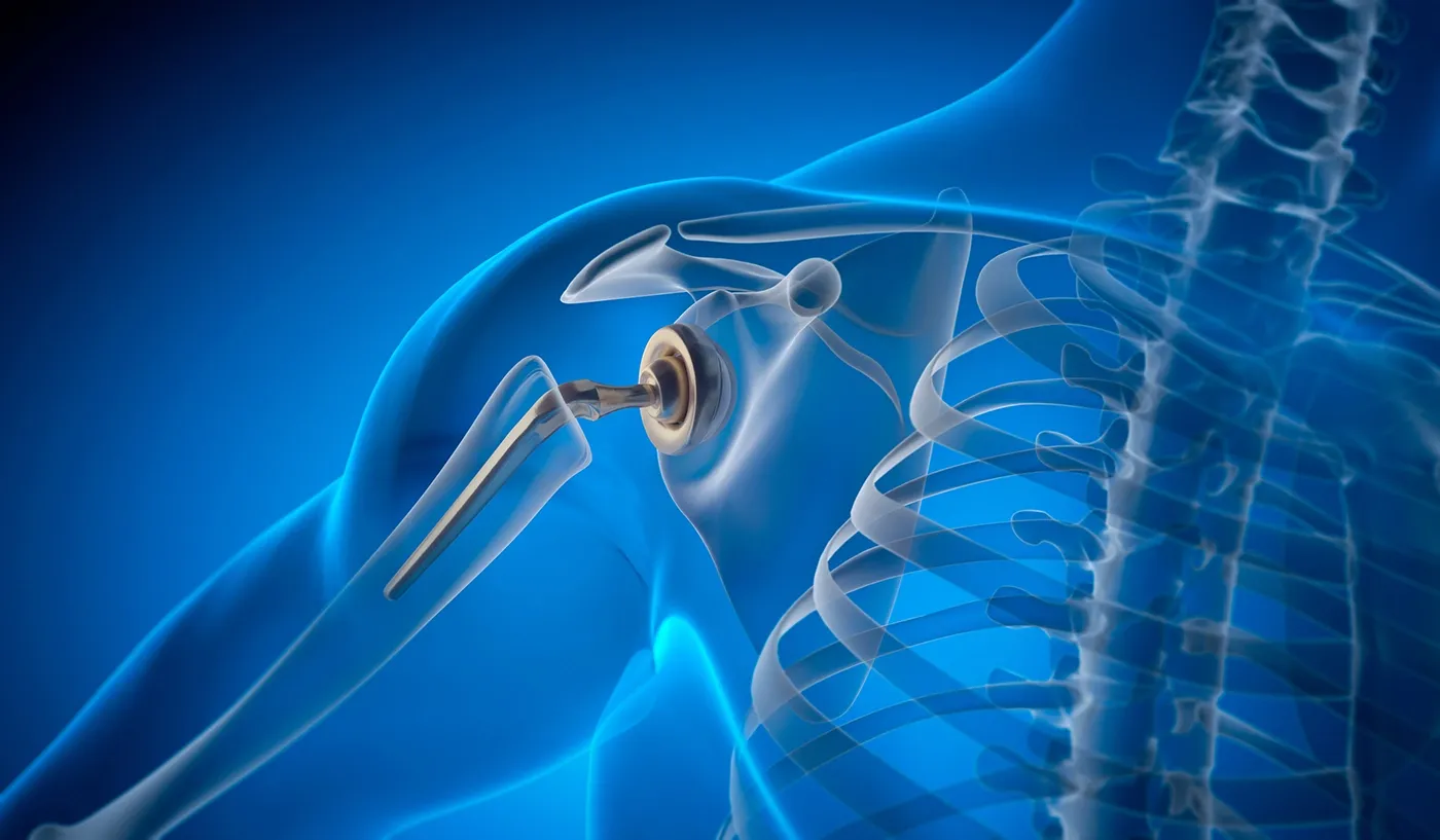 Joint Replacement & Revision Surgery