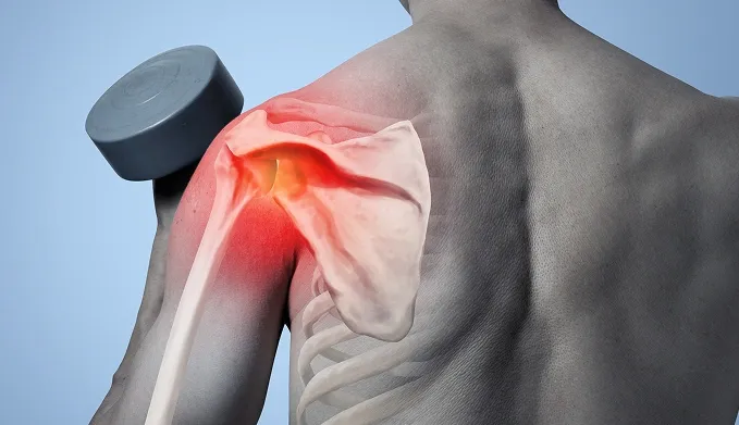 Superior Labrum Anterior and Posterior (SLAP) Tear