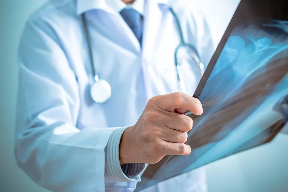 Orthopaedic surgeon examining an X-ray.