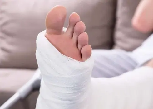 Complications of Fractures