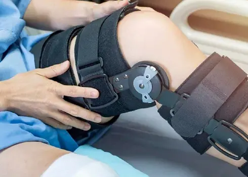 Complications of Fractures