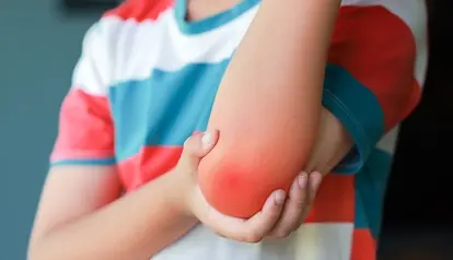 Supracondylar Fractures