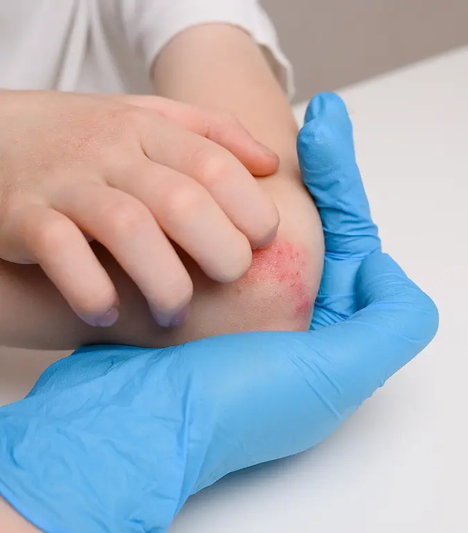 How Are Shoulder Impingement Diagnosed