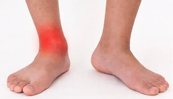 Superior Labrum Anterior and Posterior (SLAP) Tear