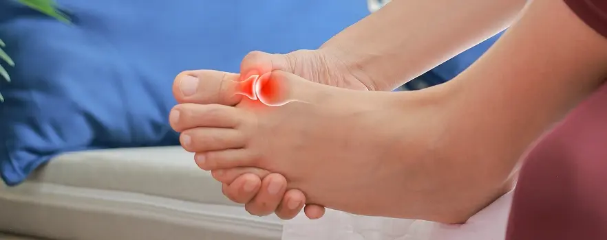 Bunion Surgery