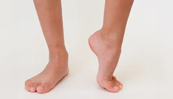 Superior Labrum Anterior and Posterior (SLAP) Tear