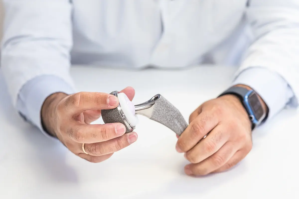 What Are the Components of a Partial Hip Replacement?