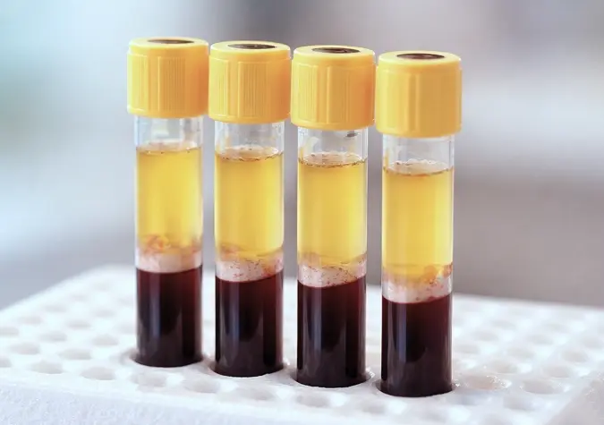 What is Being Injected