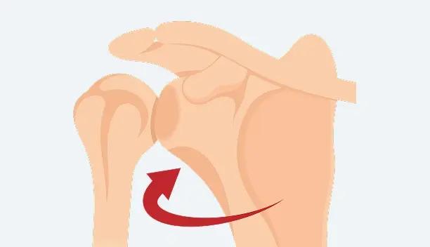 Superior Labrum Anterior and Posterior (SLAP) Tear