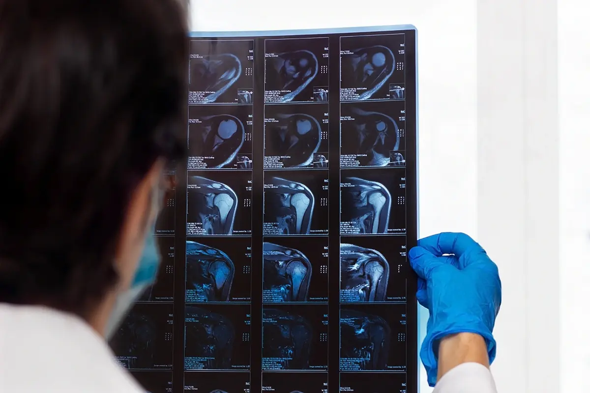 How Are Fractures in the Elderly Diagnosed?