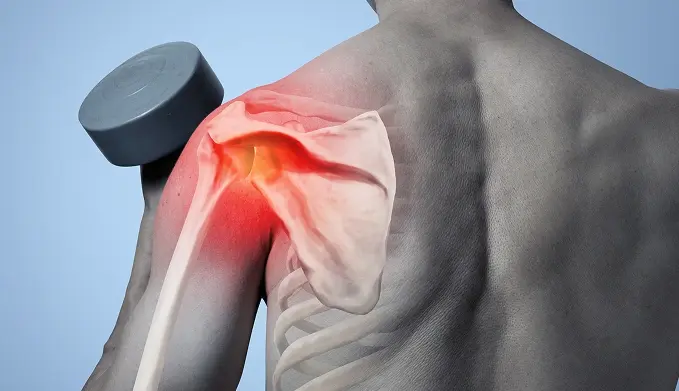 Superior Labrum Anterior and Posterior (SLAP) Tear