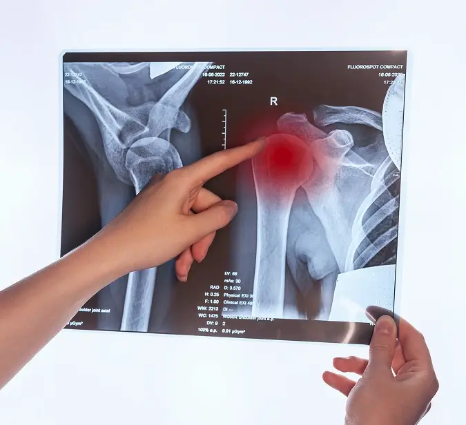 How is sciatica diagnosed