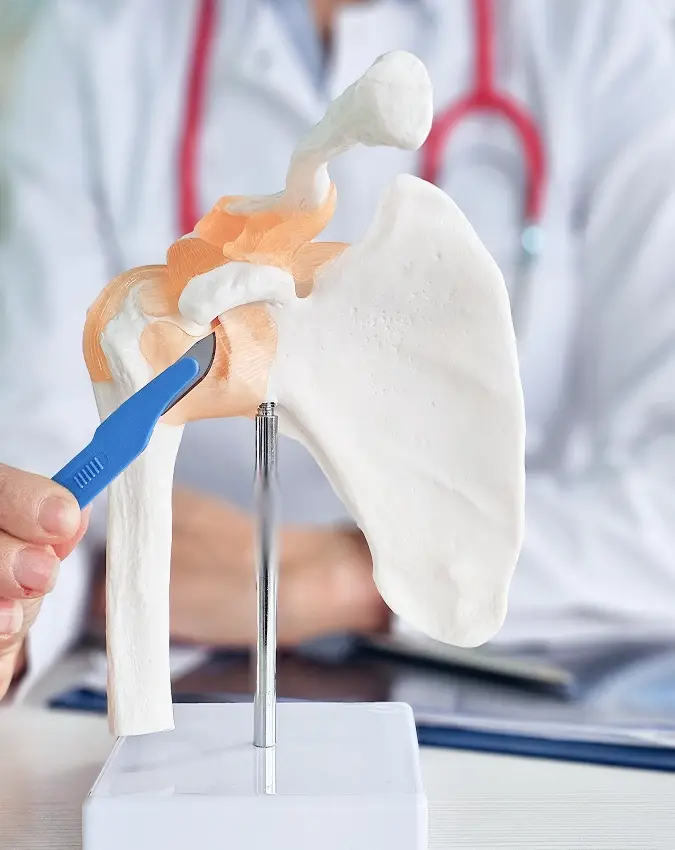 What Is Shoulder Arthroscopy and Who Needs It?