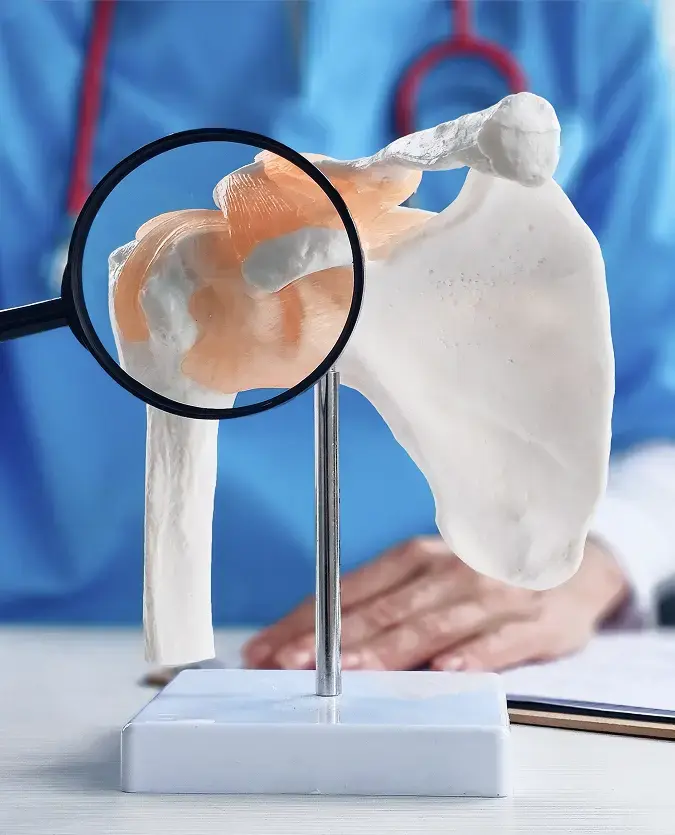 How Are Shoulder Impingement Diagnosed