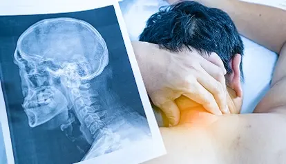 Cervical Degeneration (Neck)