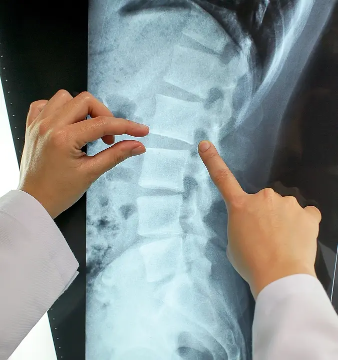 How is sciatica diagnosed