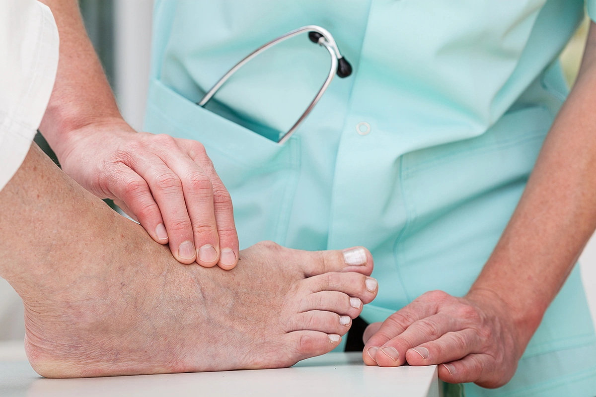 Bunion specialist examines patient’s feet