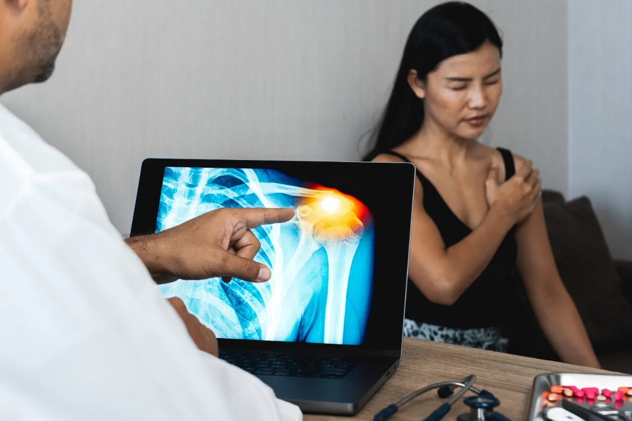 Doctor looking at an X-Ray of a patient’s shoulder