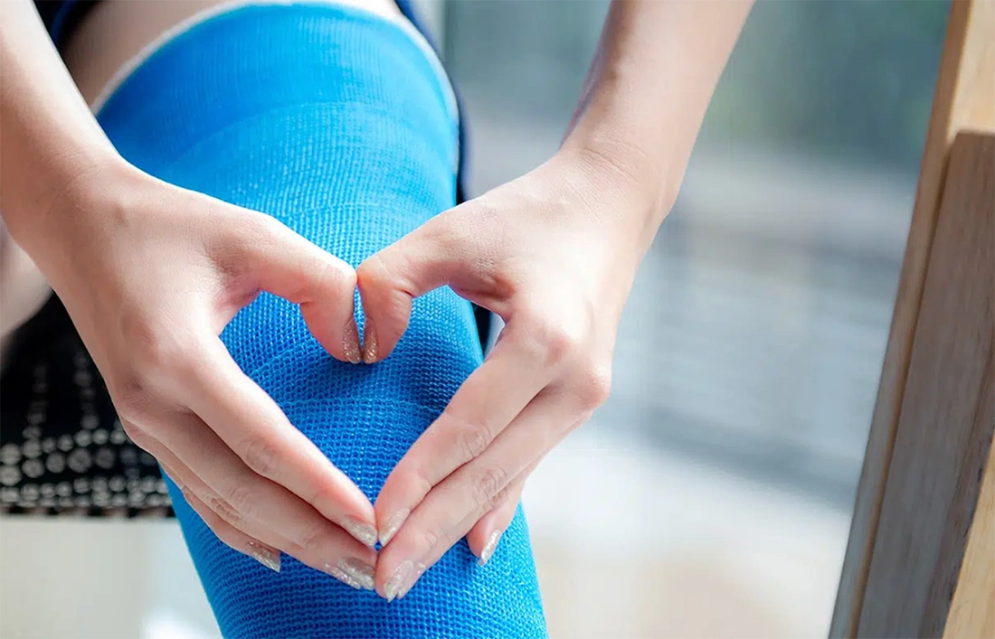 Fracture Rehabilitation: It is Not Just about Wearing a Cast