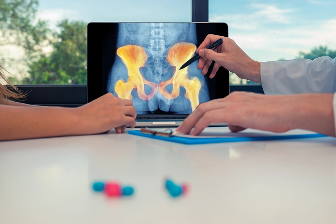 A specialist discussing hip pain treatment with a patient