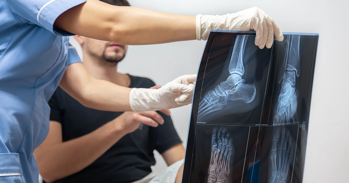 What are the Symptoms of a Fracture?