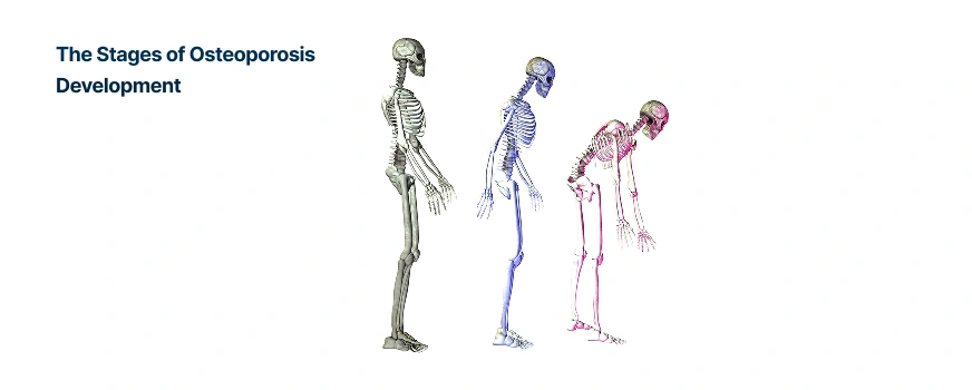 Signs and Symptoms