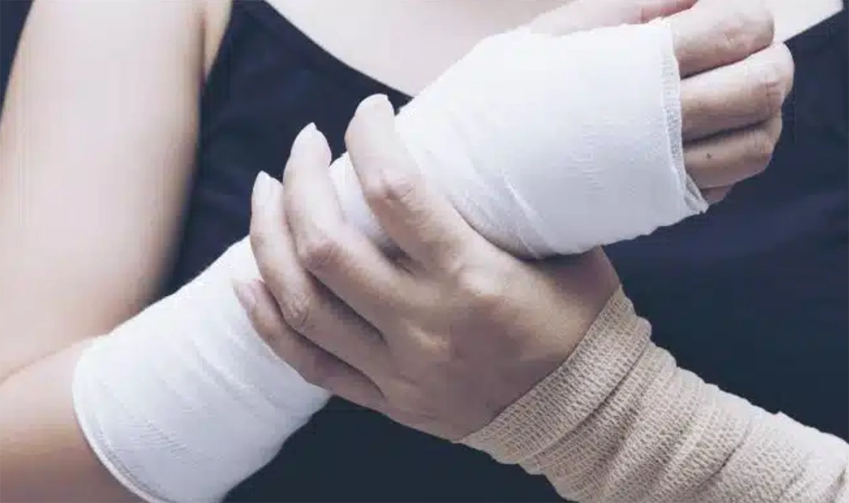 The Ultimate Guide to the Treatment of Fractures in Singapore