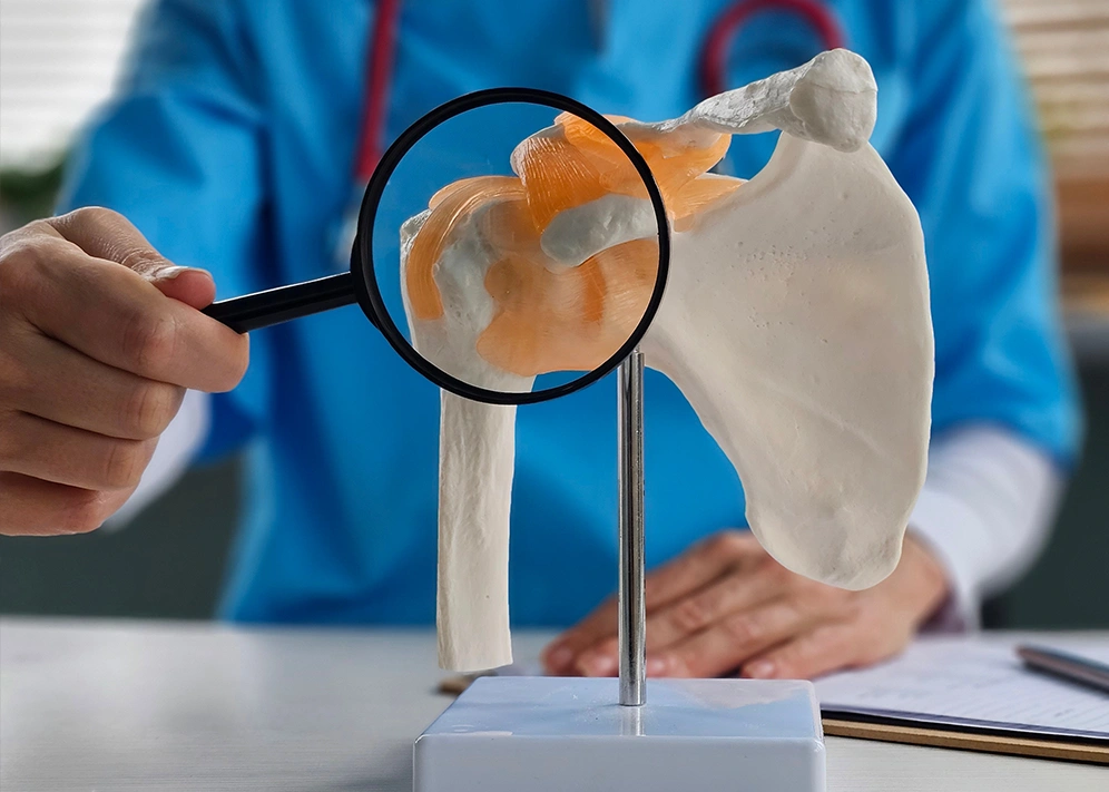 Shoulder specialist explaining to patient using shoulder joint model