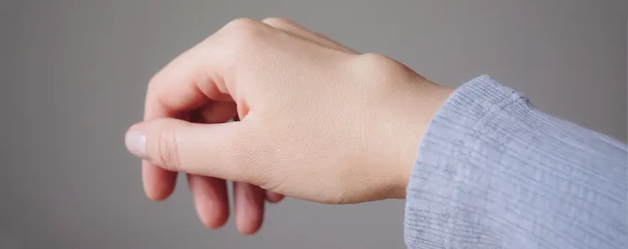 Kista Ganglion