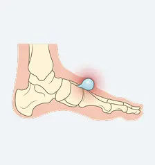 Pedal Ganglion