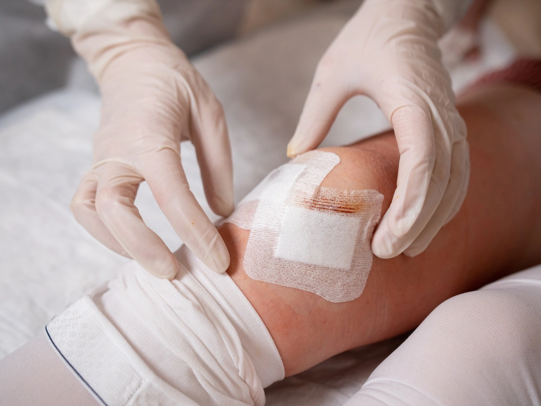 Potential Risks and Complications of Knee Arthroscopy
