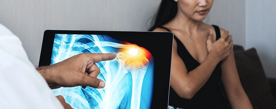 Shoulder Arthroscopy