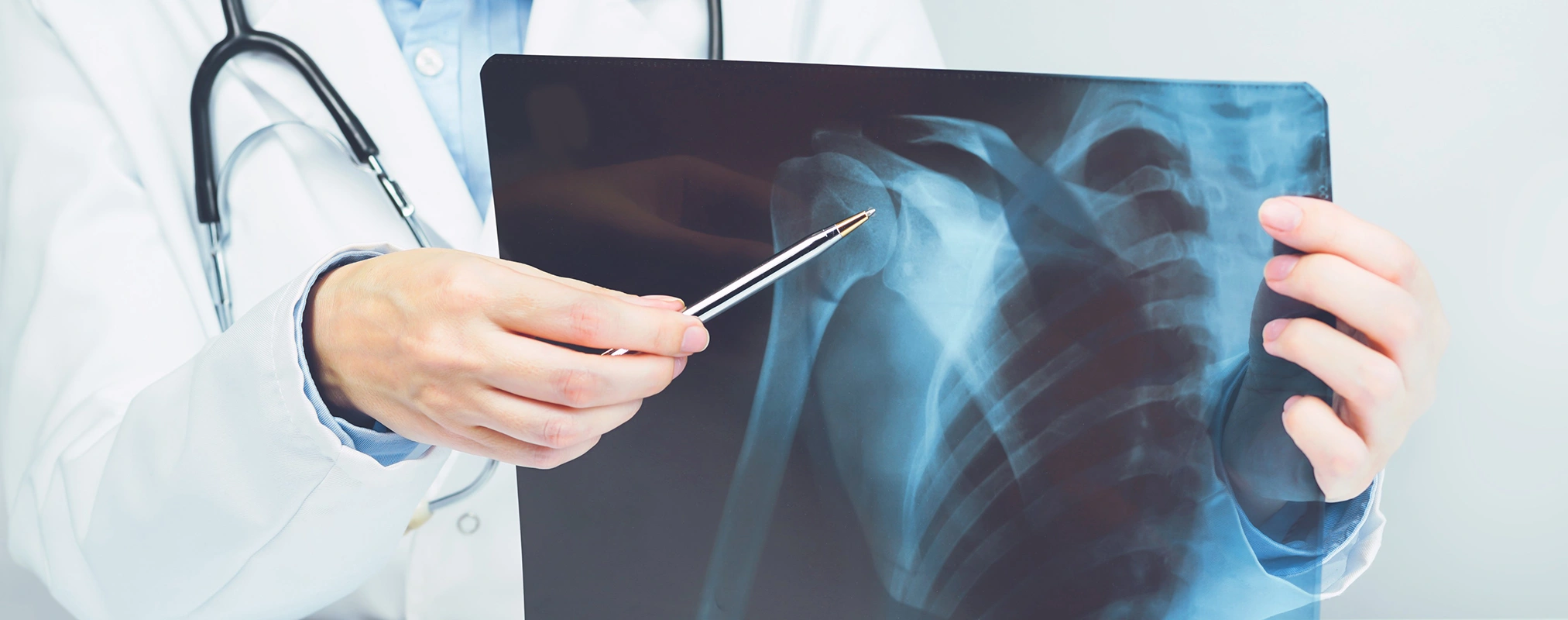 How Is Shoulder Osteoarthritis Diagnosed?