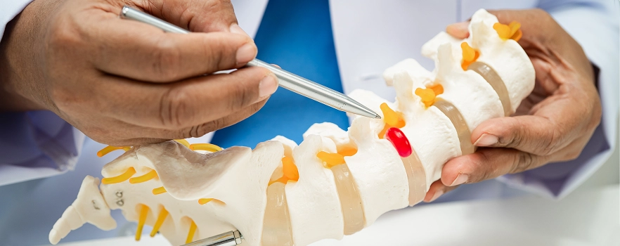 Phẫu thuật thoát vị đĩa đệm
