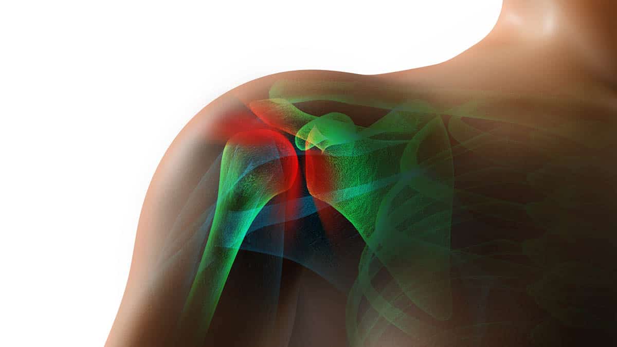 frozen shoulder pain picture