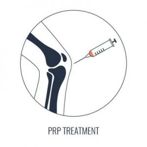 prp treatment graphic