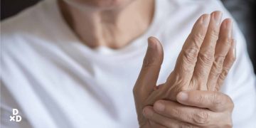 guide to treatment of arthritis in singapore